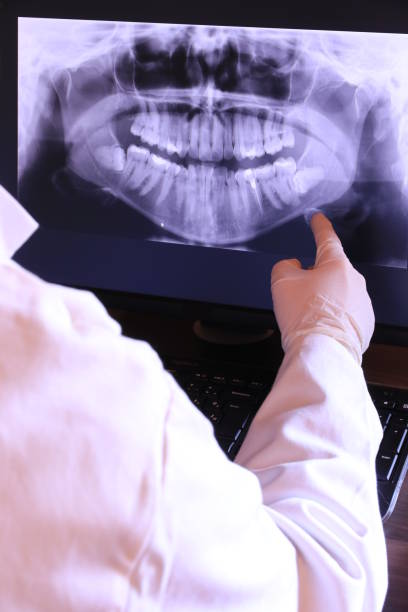 Best Emergency Root Canal Treatment in Cahokia, IL